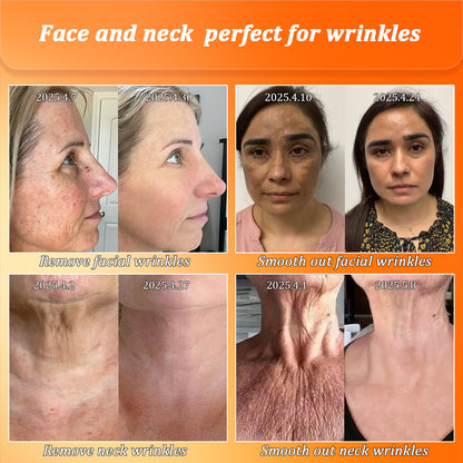 Congratulations on getting an extra 50% discount! One in a thousand chance! Last 25 pieces in stock! Dermatologist recommended!