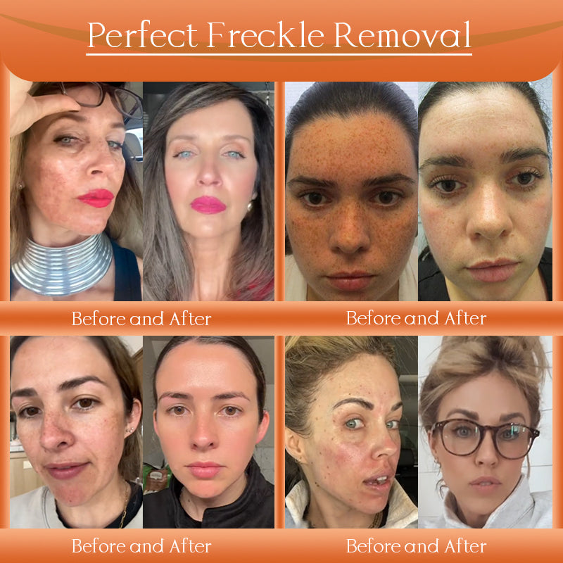 Congratulations on getting an extra 50% discount! One in a thousand chance! Last 25 pieces in stock! Dermatologist recommended!