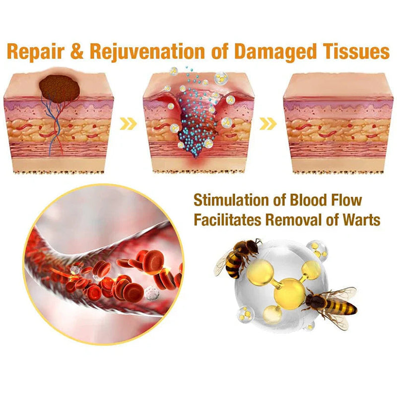 Jorondy® TagRecede Bee Venom Treatment Cream