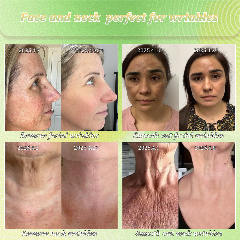 Erase Sagging Skin – The Ancient Herbal Formula Clinically Proven to Firm in Just Weeks