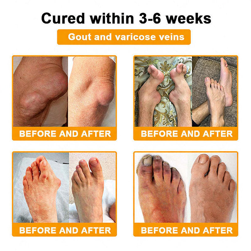 Jorondy® 🐝Bee Venom Pain-Relief Bone Healing Spray （Specially for older adults ）