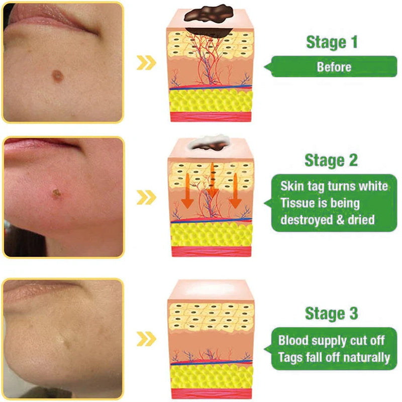 Jorondy® TagRecede Bee Venom Treatment Spray