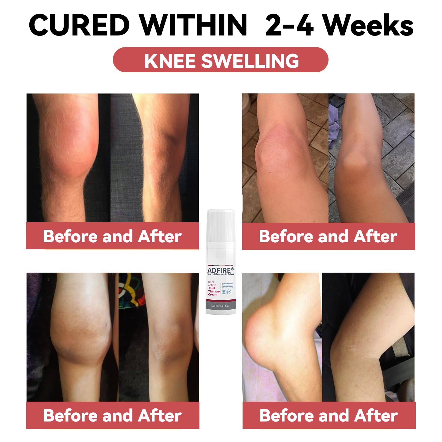 ADFIRE™ Dual Action Joint Therapy Cream