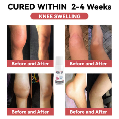ADFIRE™ Dual Action Joint Therapy Cream