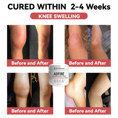 ADFIRE™ Dual Action Joint Therapy Cream