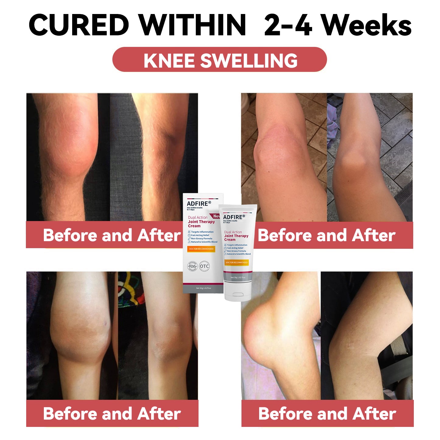 ADFIRE™ Dual Action Joint Therapy Cream