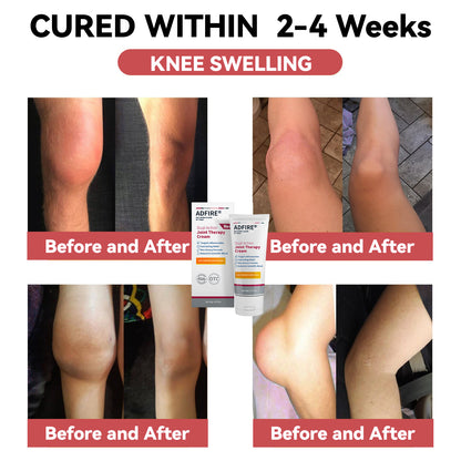 ADFIRE™ Dual Action Joint Therapy Cream