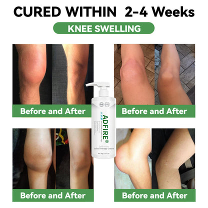 ADFIRE™ Dual Action Joint Therapy Cream