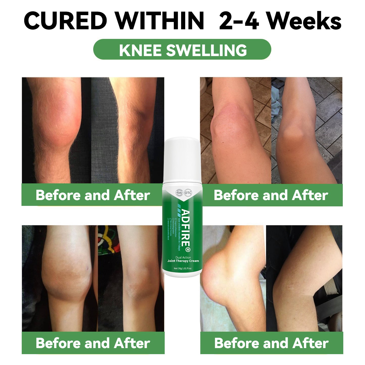 ADFIRE™ Dual Action Joint Therapy Cream