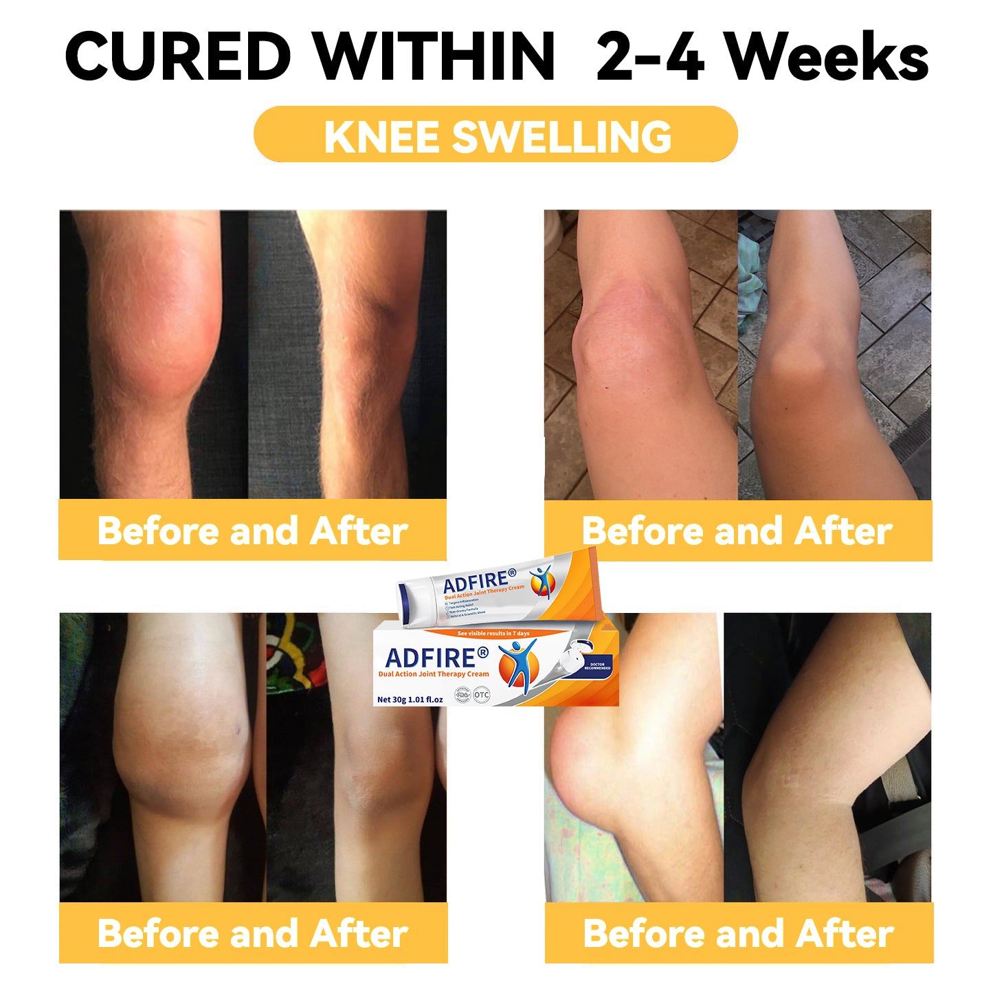 ADFIRE™ Dual Action Joint Therapy Cream