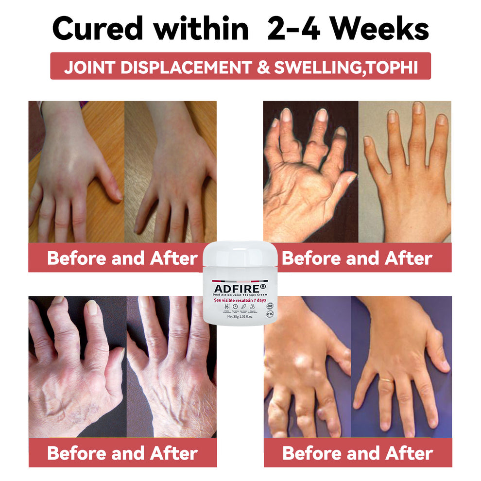 ADFIRE™ Dual Action Joint Therapy Cream