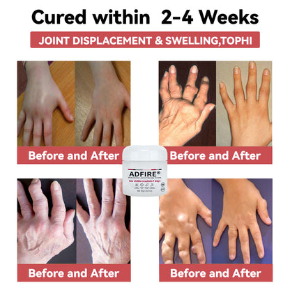 ADFIRE™ Dual Action Joint Therapy Cream