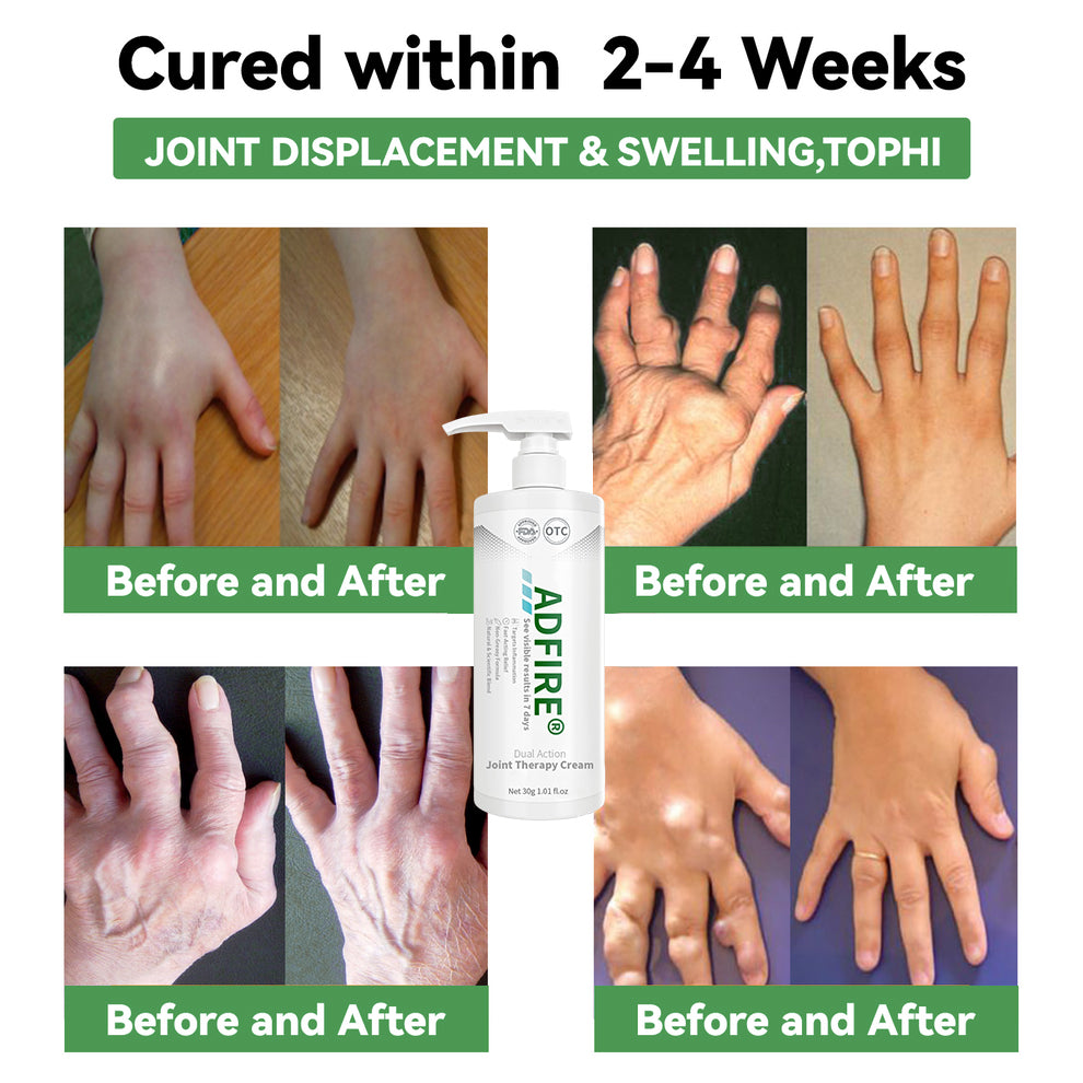 ADFIRE™ Dual Action Joint Therapy Cream