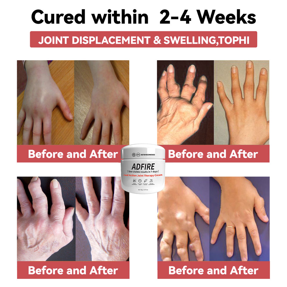 ADFIRE™ Dual Action Joint Therapy Cream