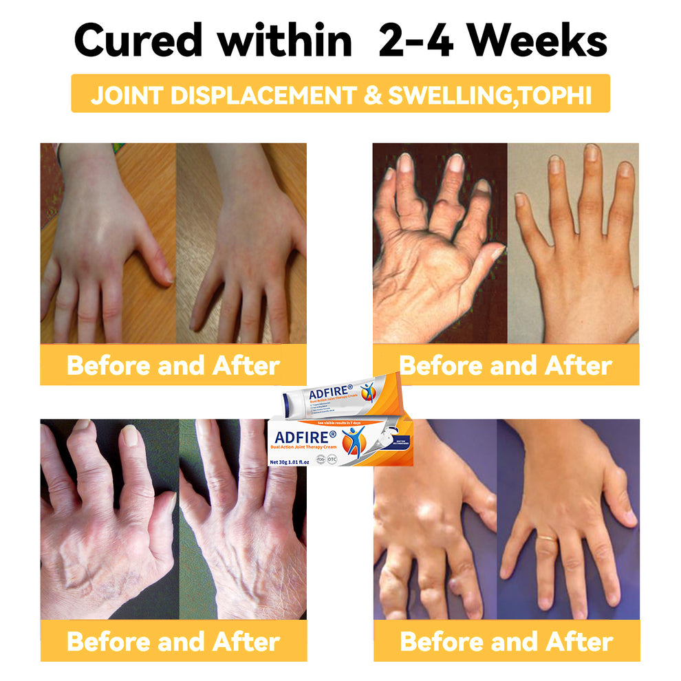 ADFIRE™ Dual Action Joint Therapy Cream