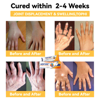 ADFIRE™ Dual Action Joint Therapy Cream