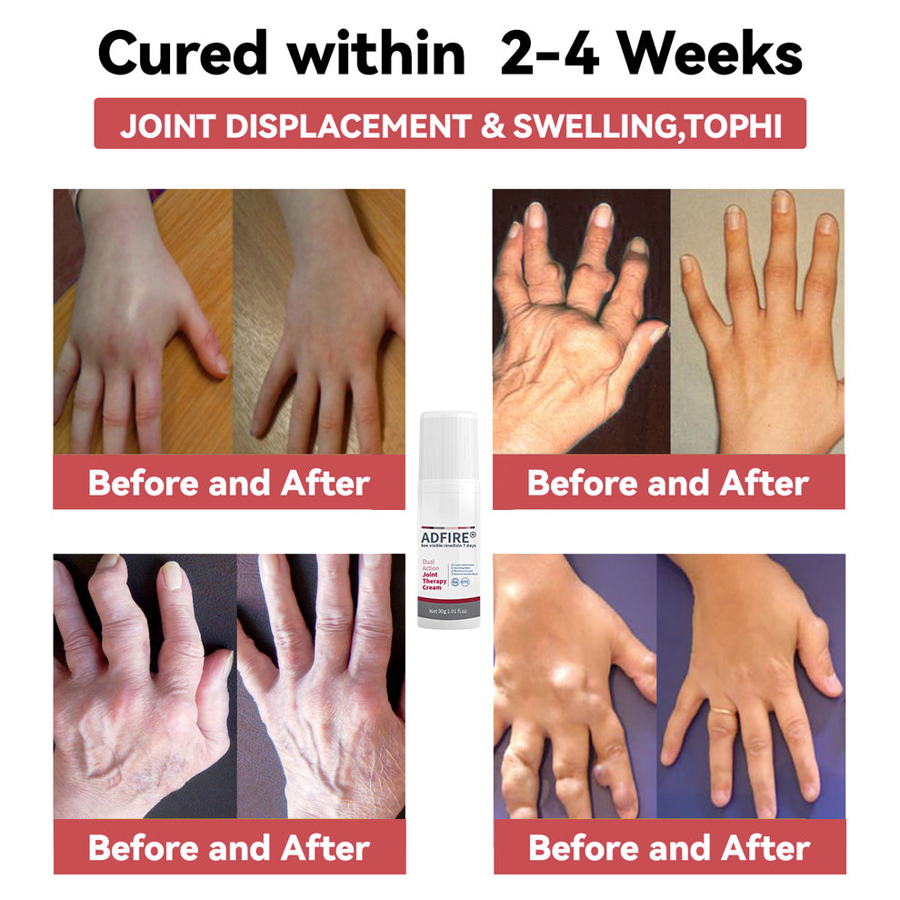 ADFIRE™ Dual Action Joint Therapy Cream
