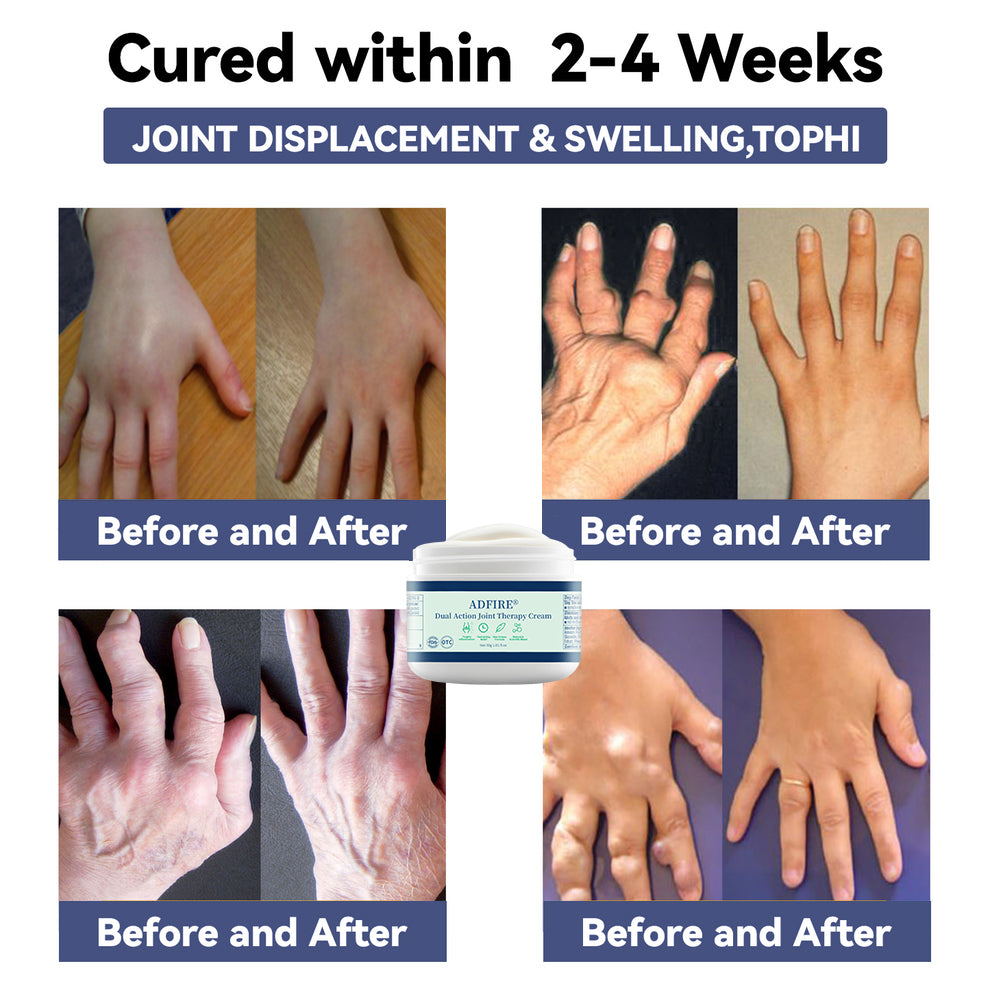 ADFIRE™ Dual Action Joint Therapy Cream