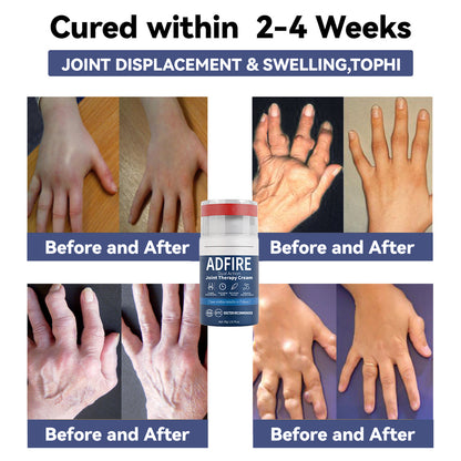 ADFIRE™ Dual Action Joint Therapy Cream