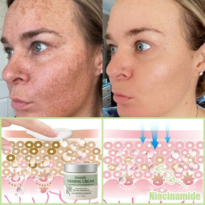 Jorondy® Firming Cream——Visibly Firms in Just 21 Days – Without Surgery or Irritation.