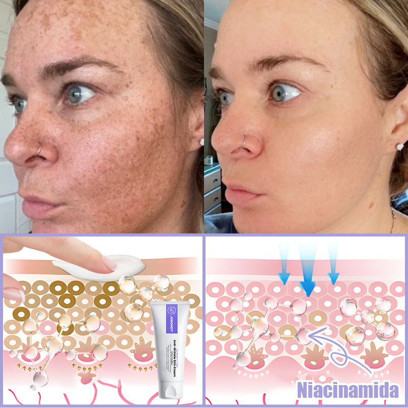 Crema antiarrugas Jorondy® para eliminar arrugas, reafirmar y blanquear la piel - ¡Última oferta!🔥 90 % de descuento.