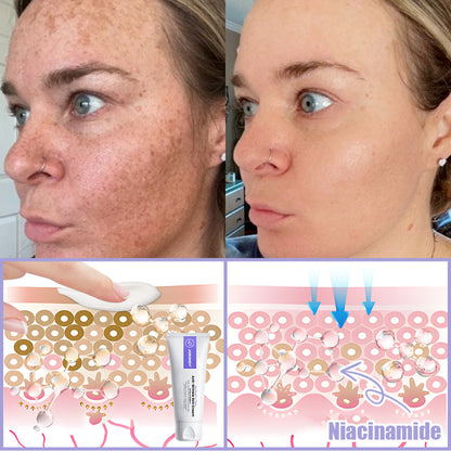 Congratulations on getting an extra 50% discount! One in a thousand chance! Last 25 pieces in stock! Dermatologist recommended!