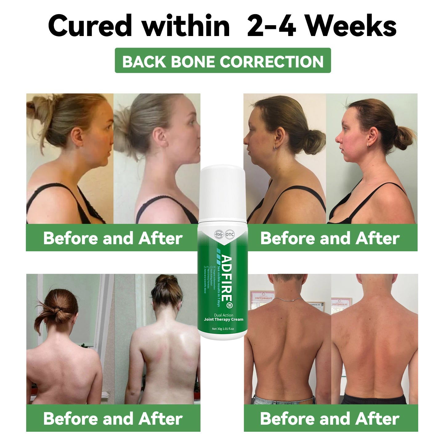 ADFIRE™ Dual Action Joint Therapy Cream