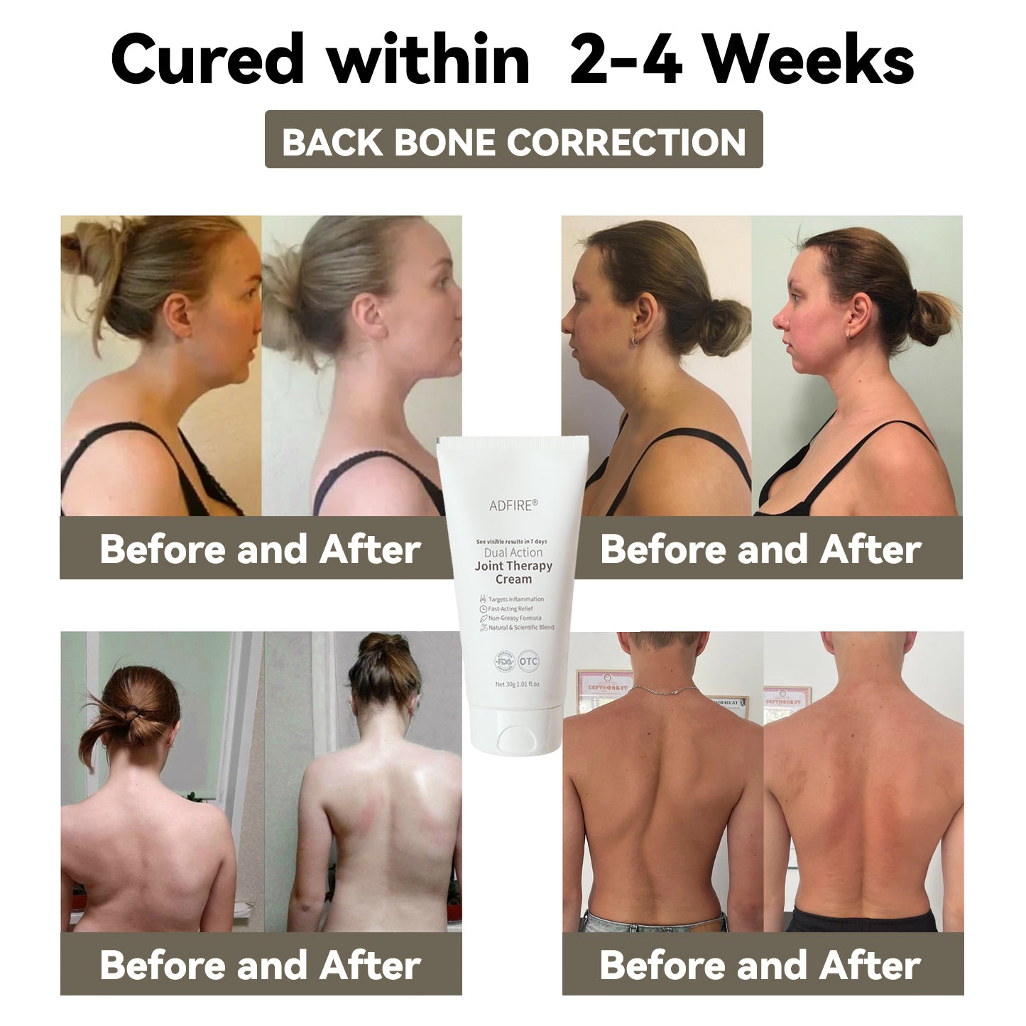 ADFIRE™ Dual Action Joint Therapy Cream