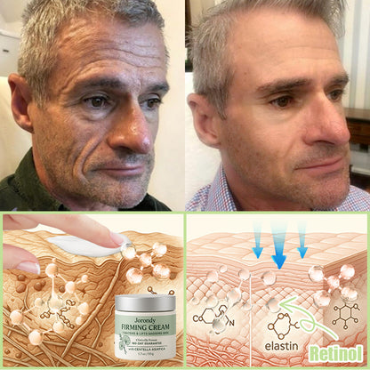 Jorondy® Firming Cream——Visibly Firms in Just 21 Days – Without Surgery or Irritation.