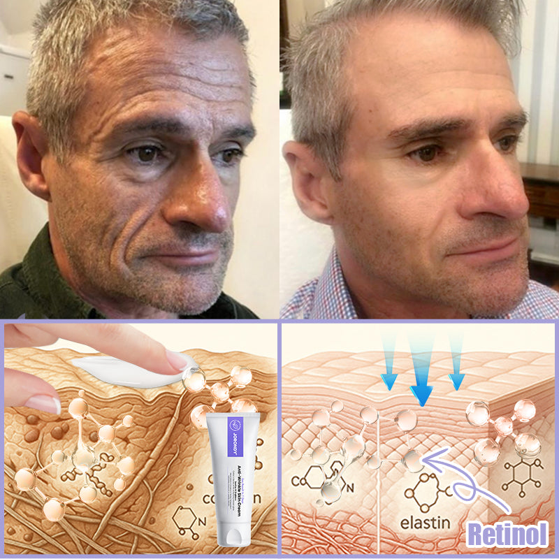 Crema antiarrugas Jorondy® para eliminar arrugas, reafirmar y blanquear la piel - ¡Última oferta!🔥 90 % de descuento.