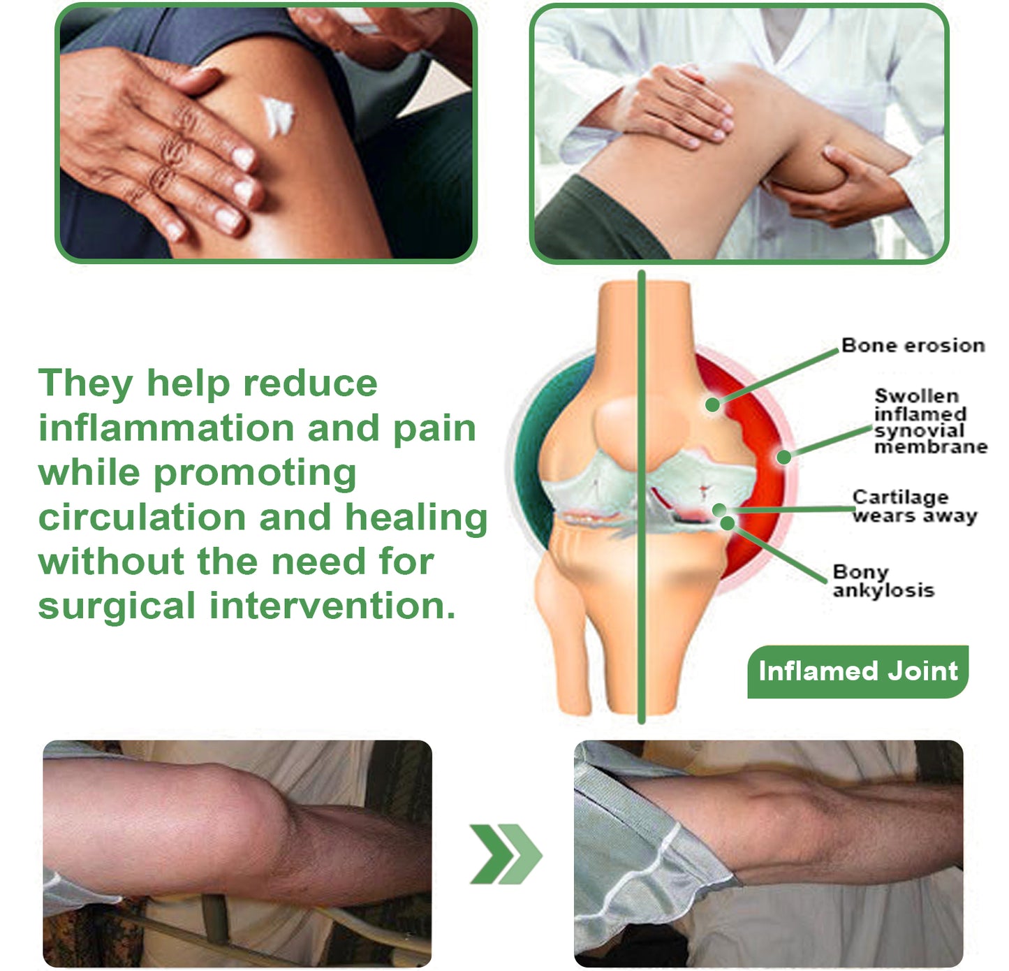 ADFIRE™ Dual Action Joint Therapy Cream