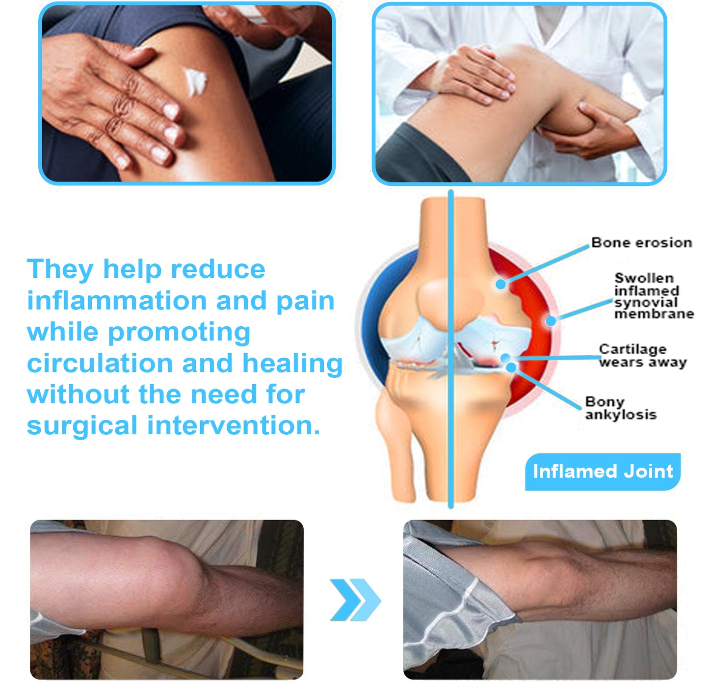 ADFIRE™ Dual Action Joint Therapy Cream