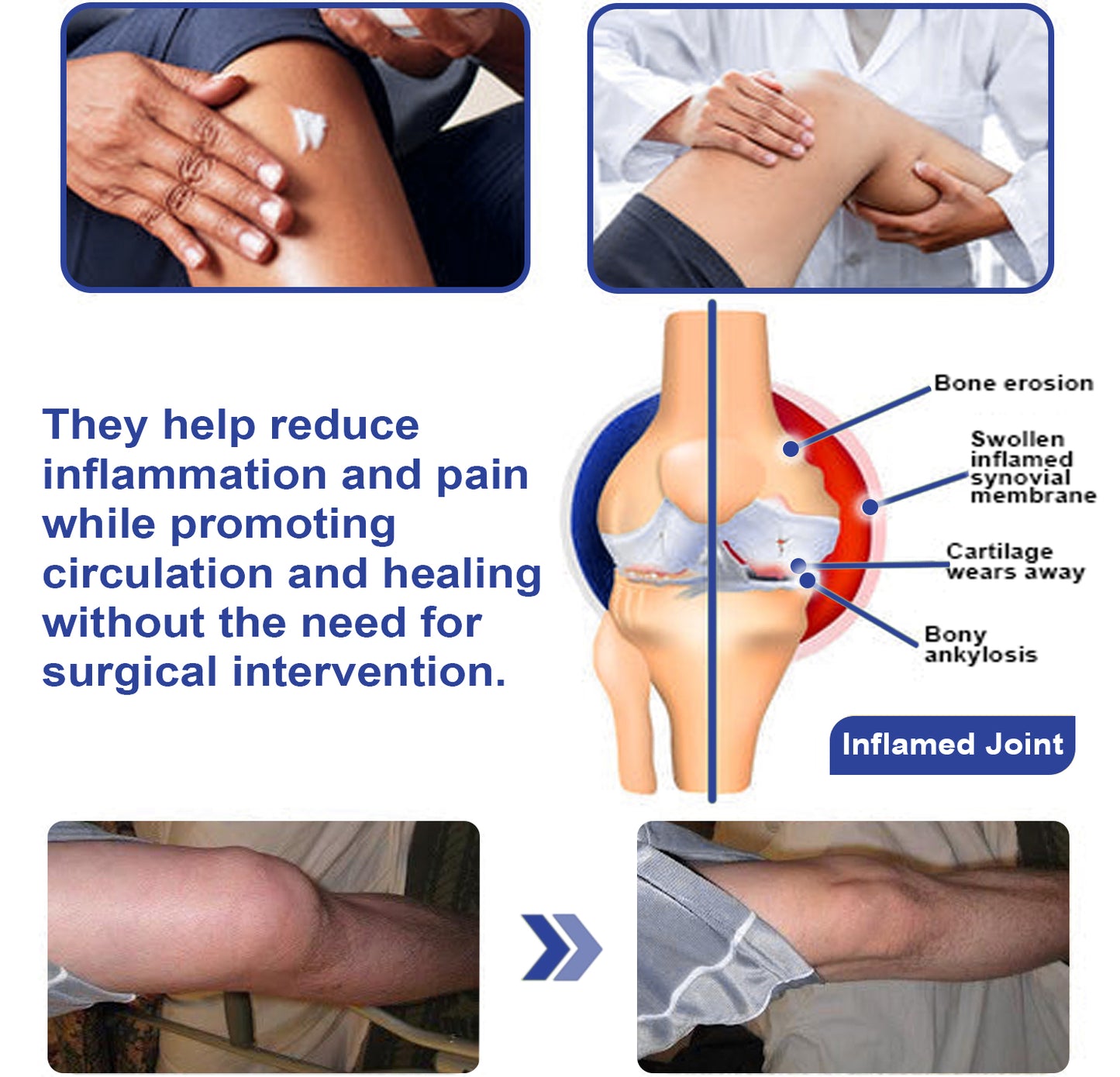 ADFIRE® Dual Action Joint Therapy Cream