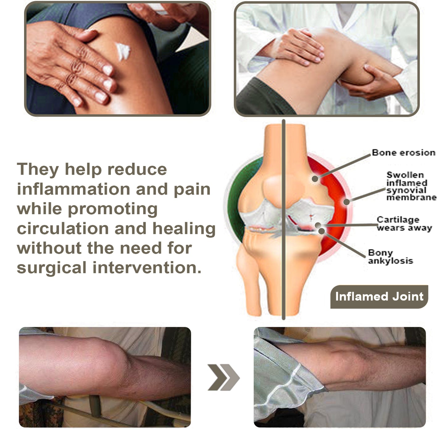 ADFIRE™ Dual Action Joint Therapy Cream