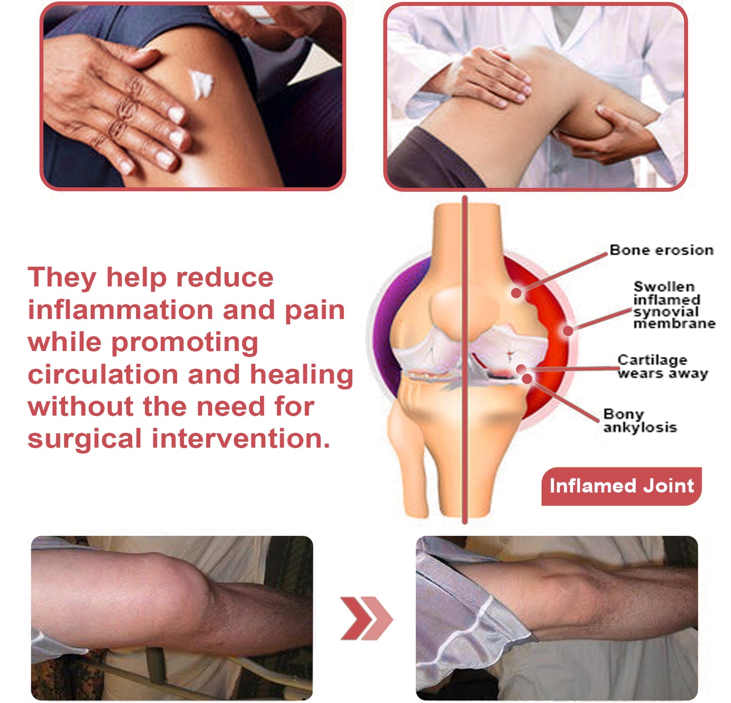 ADFIRE™ Dual Action Joint Therapy Cream
